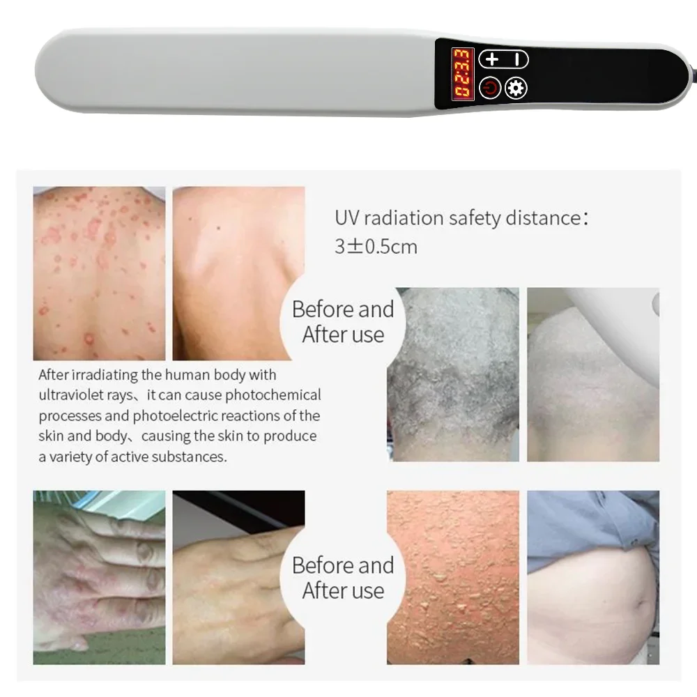Lampada per Fototerapia UVB a  - Candle Making Supplies Uk recensione e prezzo